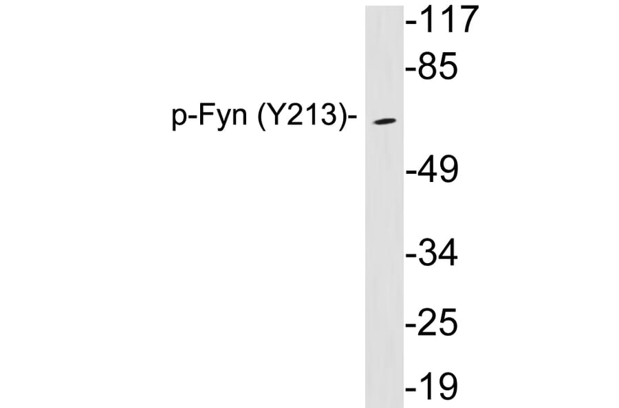 Western Blot - Anti-Fyn (phospho Tyr213) Antibody (P12-1023) - Antibodies.com