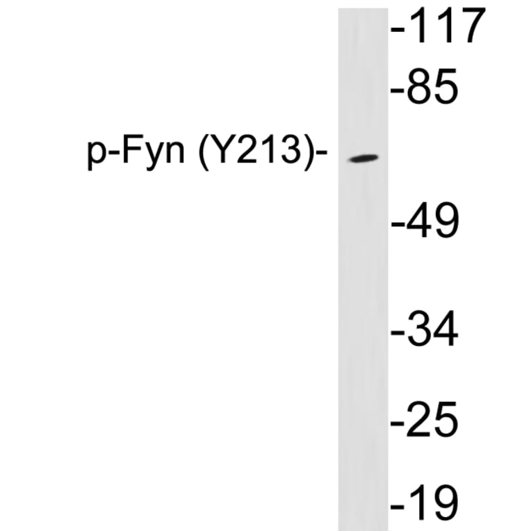 Western Blot - Anti-Fyn (phospho Tyr213) Antibody (P12-1023) - Antibodies.com