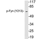 Western Blot - Anti-Fyn (phospho Tyr213) Antibody (P12-1023) - Antibodies.com