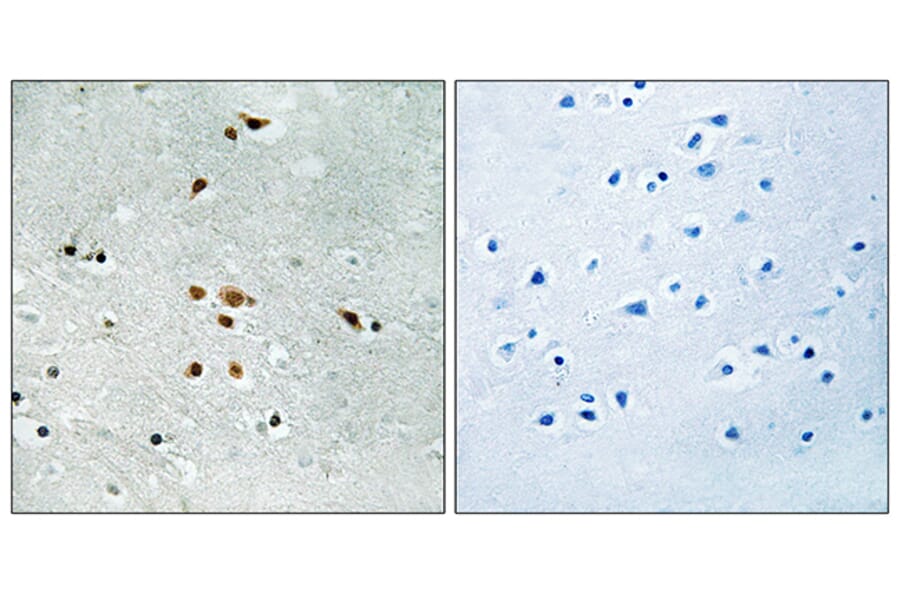Immunohistochemistry - Anti-FER (phospho Tyr402) Antibody (A8100) - Antibodies.com