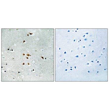 Immunohistochemistry - Anti-FER (phospho Tyr402) Antibody (A8100) - Antibodies.com