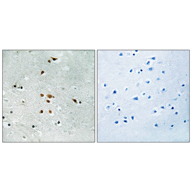 Immunohistochemistry - Anti-FER (phospho Tyr402) Antibody (A8100) - Antibodies.com