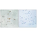 Immunohistochemistry - Anti-FER (phospho Tyr402) Antibody (A8100) - Antibodies.com