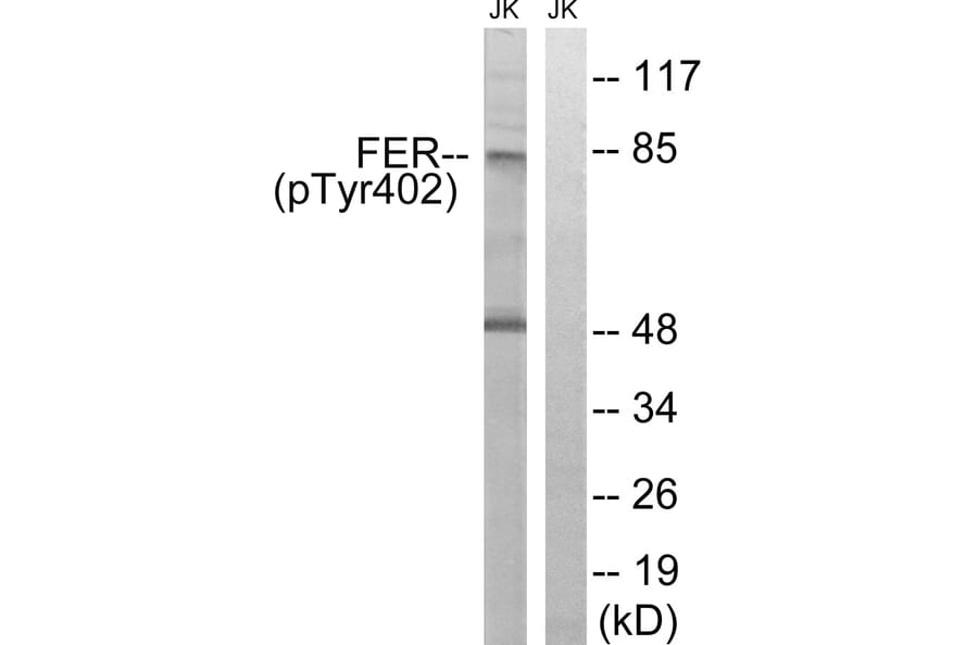 Western Blot - Anti-FER (phospho Tyr402) Antibody (A8100) - Antibodies.com