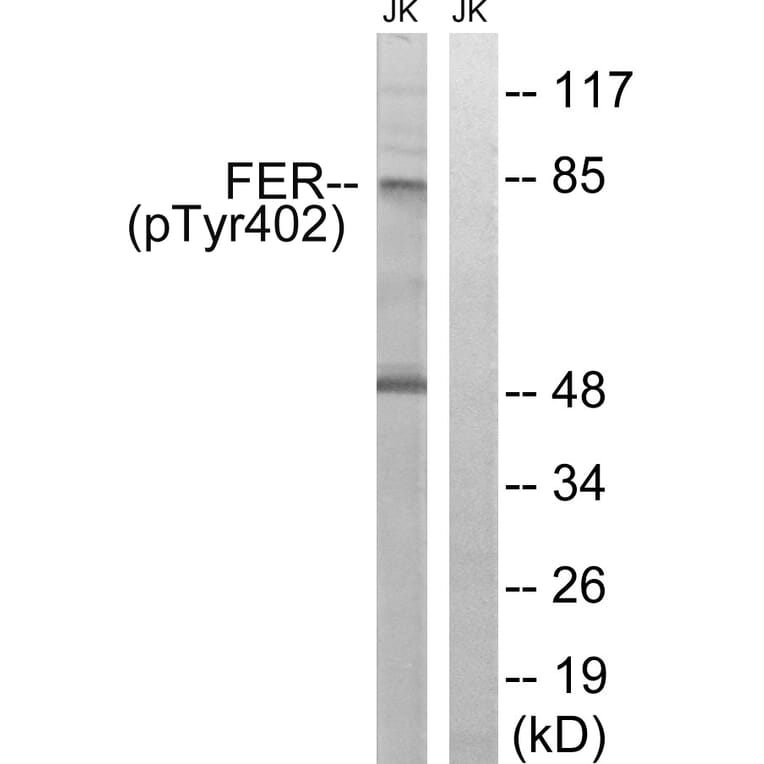 Western Blot - Anti-FER (phospho Tyr402) Antibody (A8100) - Antibodies.com