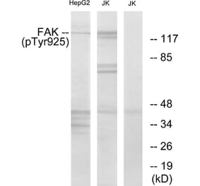 Western Blot - Anti-FAK (phospho Tyr925) Antibody (A7083) - Antibodies.com