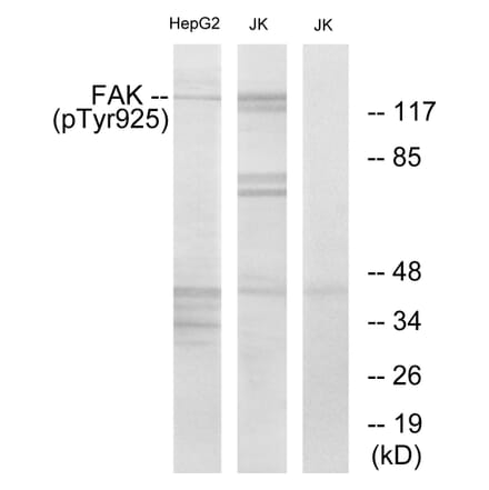 Western Blot - Anti-FAK (phospho Tyr925) Antibody (A7083) - Antibodies.com