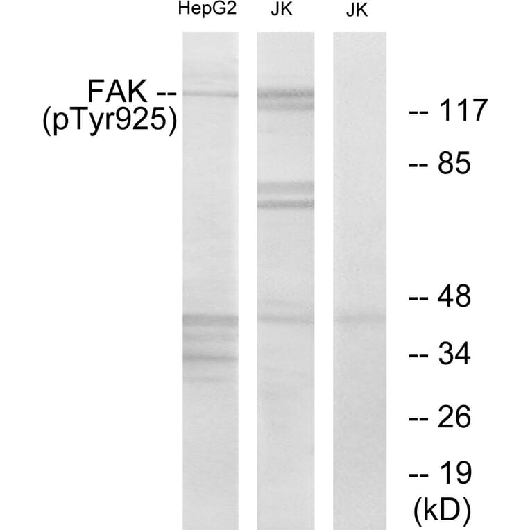 Western Blot - Anti-FAK (phospho Tyr925) Antibody (A7083) - Antibodies.com
