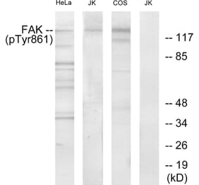 Western Blot - Anti-FAK (phospho Tyr861) Antibody (A7082) - Antibodies.com