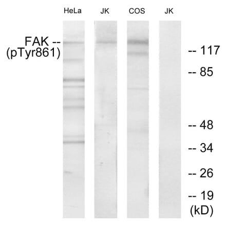 Western Blot - Anti-FAK (phospho Tyr861) Antibody (A7082) - Antibodies.com