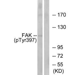 Western Blot - Anti-FAK (phospho Tyr397) Antibody (A7081) - Antibodies.com