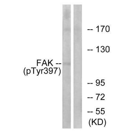 Western Blot - Anti-FAK (phospho Tyr397) Antibody (A7081) - Antibodies.com