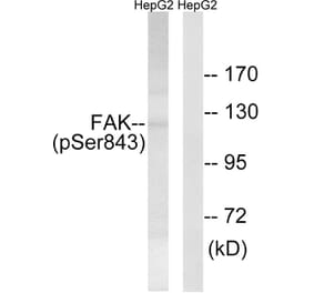 Western Blot - Anti-FAK (phospho Ser843) Antibody (A8032) - Antibodies.com