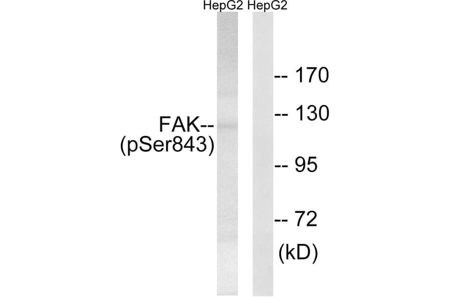 Western Blot - Anti-FAK (phospho Ser843) Antibody (A8032) - Antibodies.com