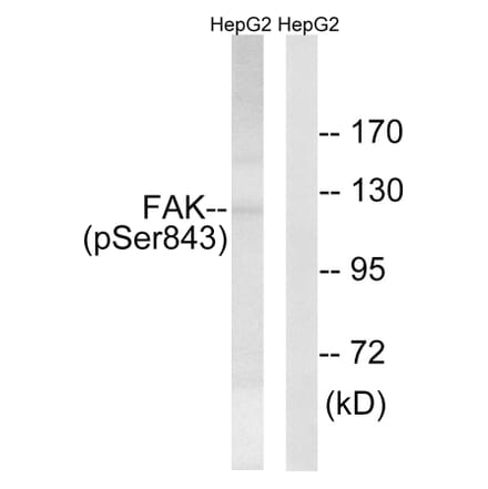 Western Blot - Anti-FAK (phospho Ser843) Antibody (A8032) - Antibodies.com