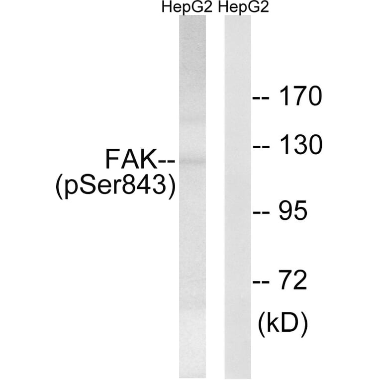 Western Blot - Anti-FAK (phospho Ser843) Antibody (A8032) - Antibodies.com
