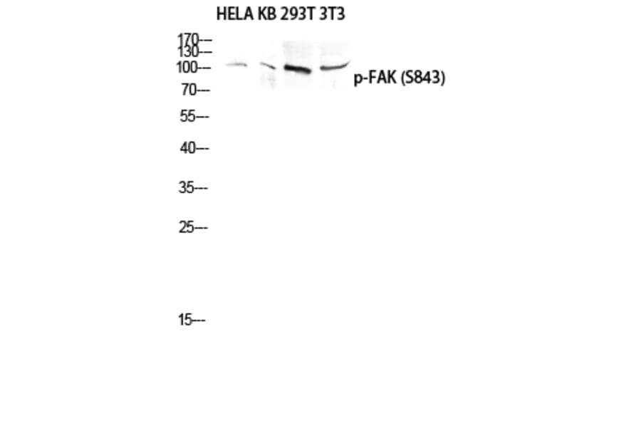 Western Blot - Anti-FAK (phospho Ser843) Antibody (A8032) - Antibodies.com