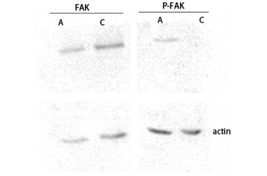 Western Blot - Anti-FAK (phospho Ser843) Antibody (A8032) - Antibodies.com