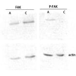 Western Blot - Anti-FAK (phospho Ser843) Antibody (A8032) - Antibodies.com