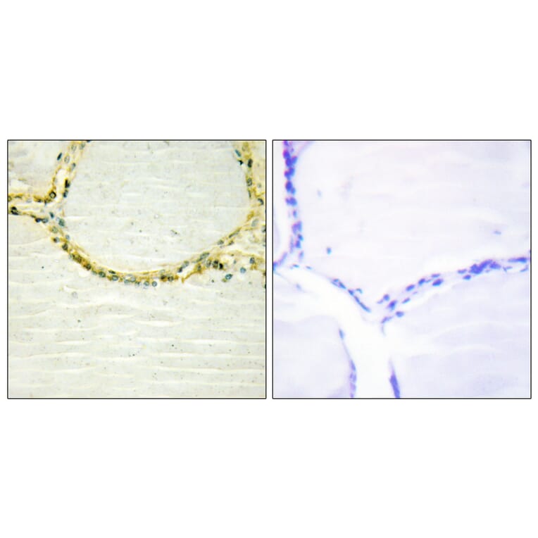 Immunohistochemistry - Anti-ETK (phospho Tyr566) Antibody (A0787) - Antibodies.com