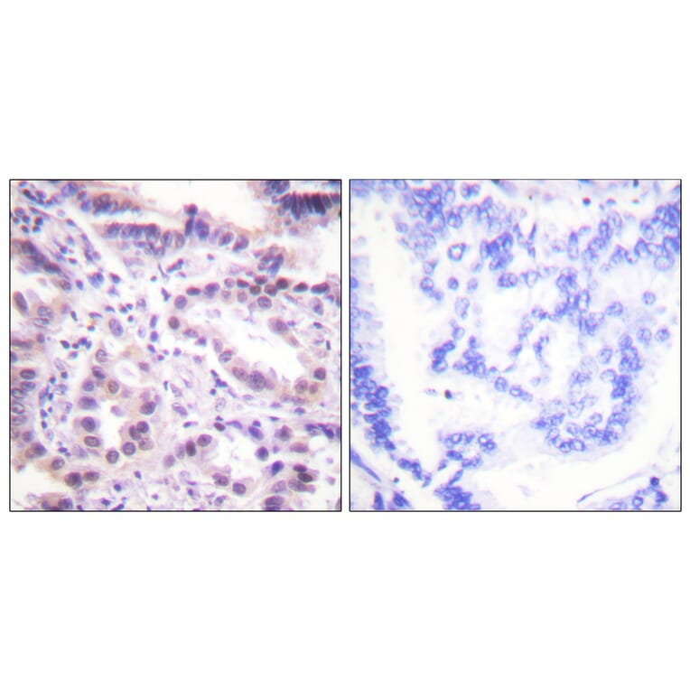 Immunohistochemistry - Anti-ERF (phospho Thr526) Antibody (A0477) - Antibodies.com