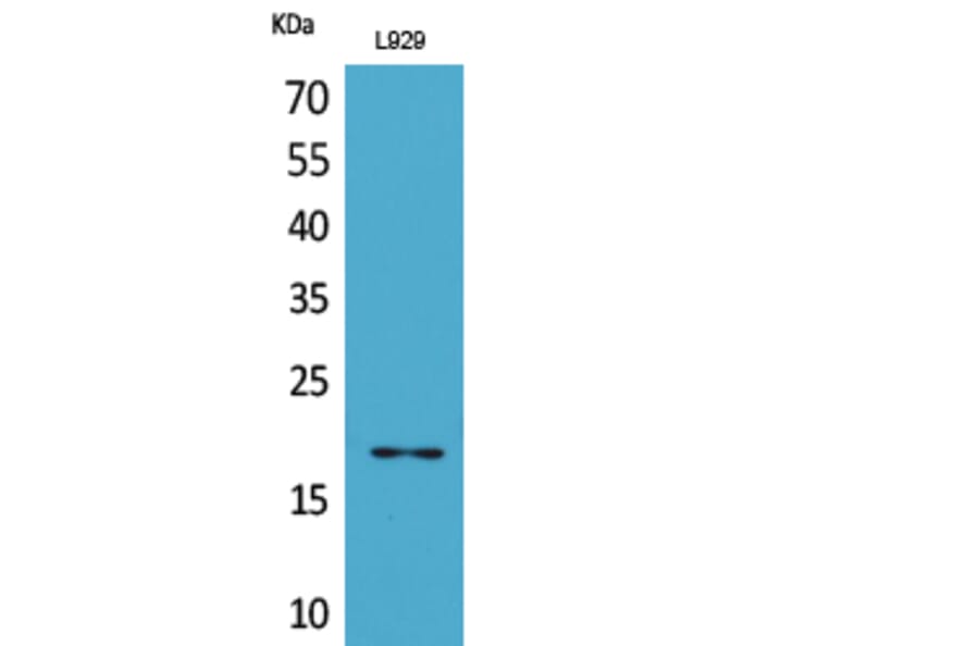 Western Blot - Anti-eIF5A (acetyl Lys47) Antibody (D12065) - Antibodies.com