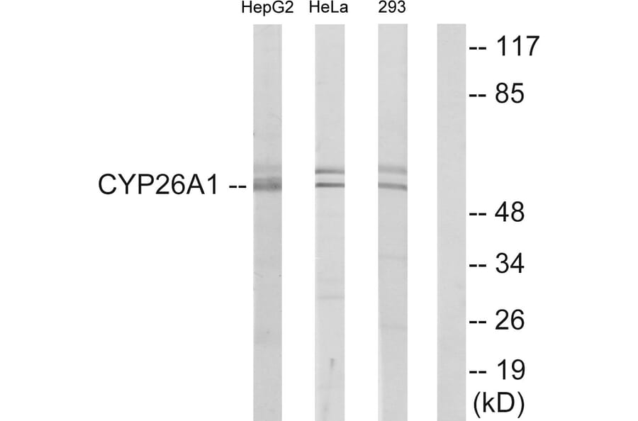Western Blot - Anti-Cytochrome P450 26A1 Antibody (C12254) - Antibodies.com