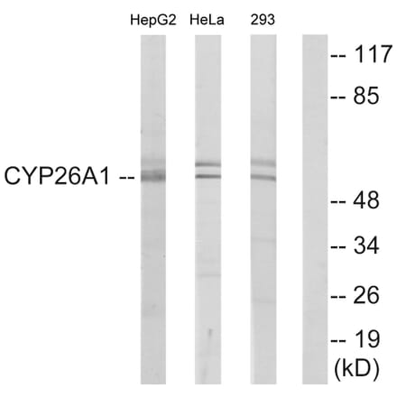Western Blot - Anti-Cytochrome P450 26A1 Antibody (C12254) - Antibodies.com