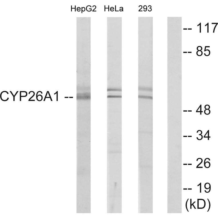 Western Blot - Anti-Cytochrome P450 26A1 Antibody (C12254) - Antibodies.com