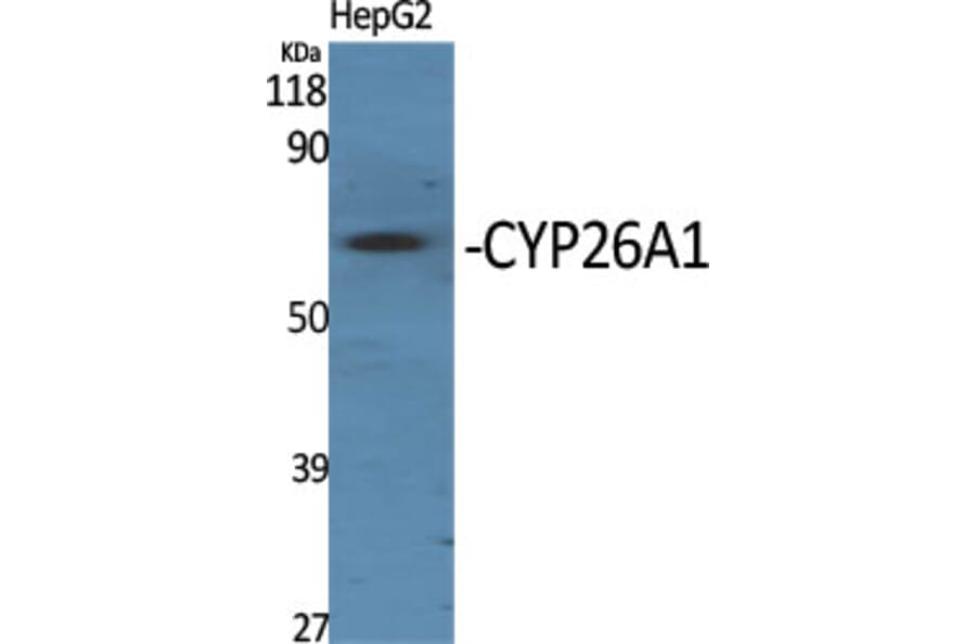 Western Blot - Anti-Cytochrome P450 26A1 Antibody (C12254) - Antibodies.com