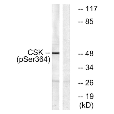 Western Blot - Anti-Csk (phospho Ser364) Antibody (A0415) - Antibodies.com