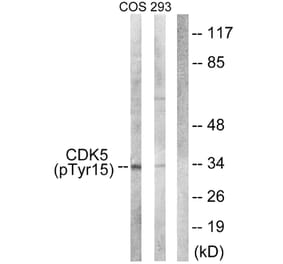 Western Blot - Anti-CDK5 (phospho Tyr15) Antibody (A1141) - Antibodies.com