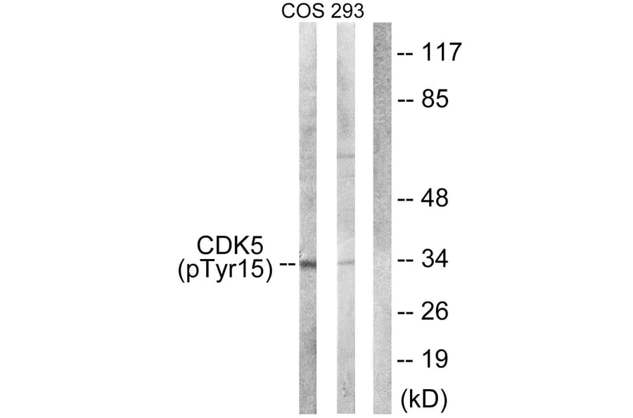 Western Blot - Anti-CDK5 (phospho Tyr15) Antibody (A1141) - Antibodies.com