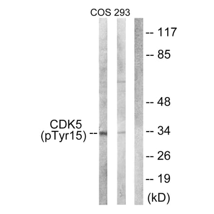 Western Blot - Anti-CDK5 (phospho Tyr15) Antibody (A1141) - Antibodies.com