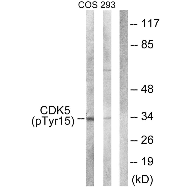 Western Blot - Anti-CDK5 (phospho Tyr15) Antibody (A1141) - Antibodies.com