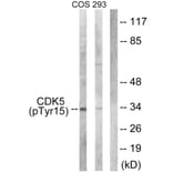 Western Blot - Anti-CDK5 (phospho Tyr15) Antibody (A1141) - Antibodies.com