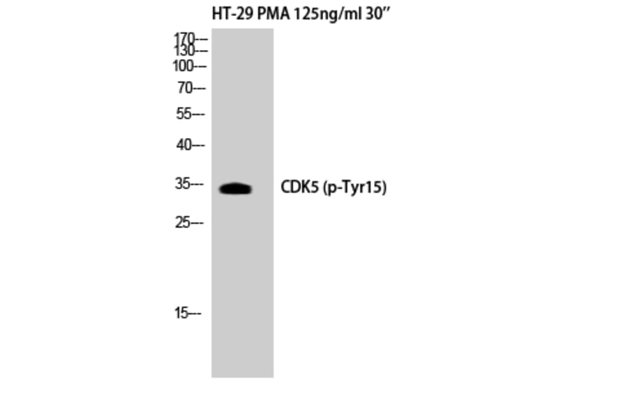 Western Blot - Anti-CDK5 (phospho Tyr15) Antibody (A1141) - Antibodies.com