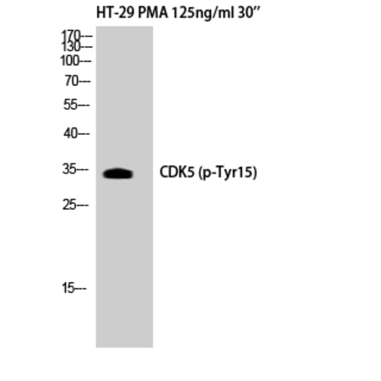 Western Blot - Anti-CDK5 (phospho Tyr15) Antibody (A1141) - Antibodies.com