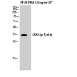 Western Blot - Anti-CDK5 (phospho Tyr15) Antibody (A1141) - Antibodies.com