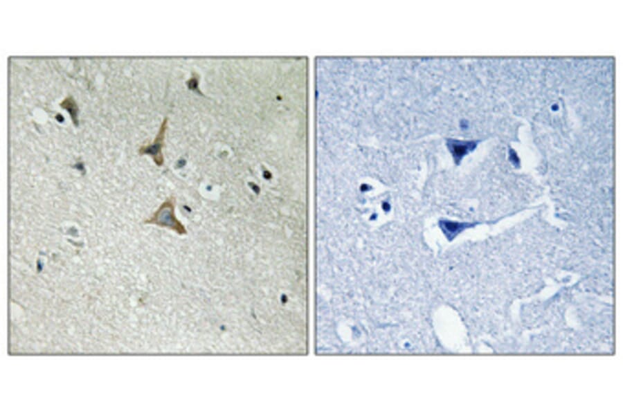 Immunohistochemistry - Anti-CDK5 (phospho Tyr15) Antibody (A1141) - Antibodies.com
