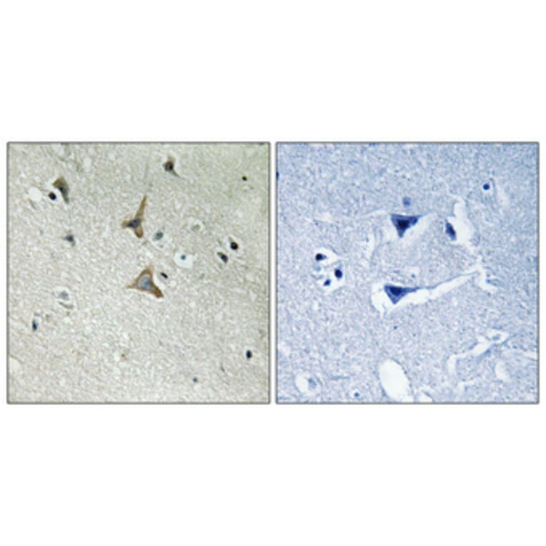 Immunohistochemistry - Anti-CDK5 (phospho Tyr15) Antibody (A1141) - Antibodies.com