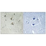 Immunohistochemistry - Anti-CDK5 (phospho Tyr15) Antibody (A1141) - Antibodies.com