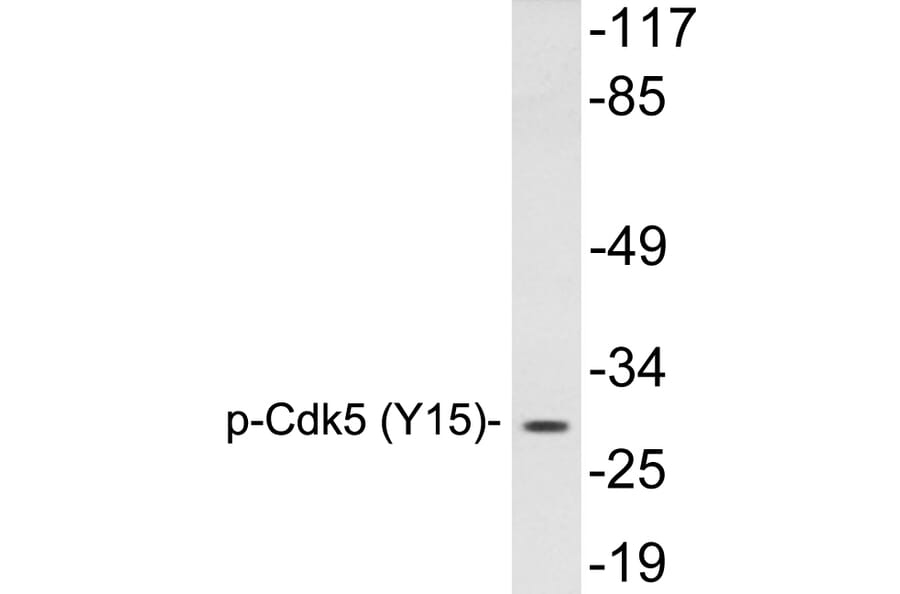 Western Blot - Anti-Cdk5 (phospho Tyr15) Antibody (P12-1013) - Antibodies.com