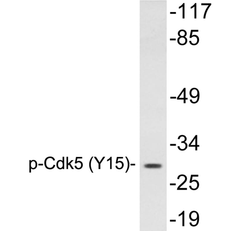 Western Blot - Anti-Cdk5 (phospho Tyr15) Antibody (P12-1013) - Antibodies.com