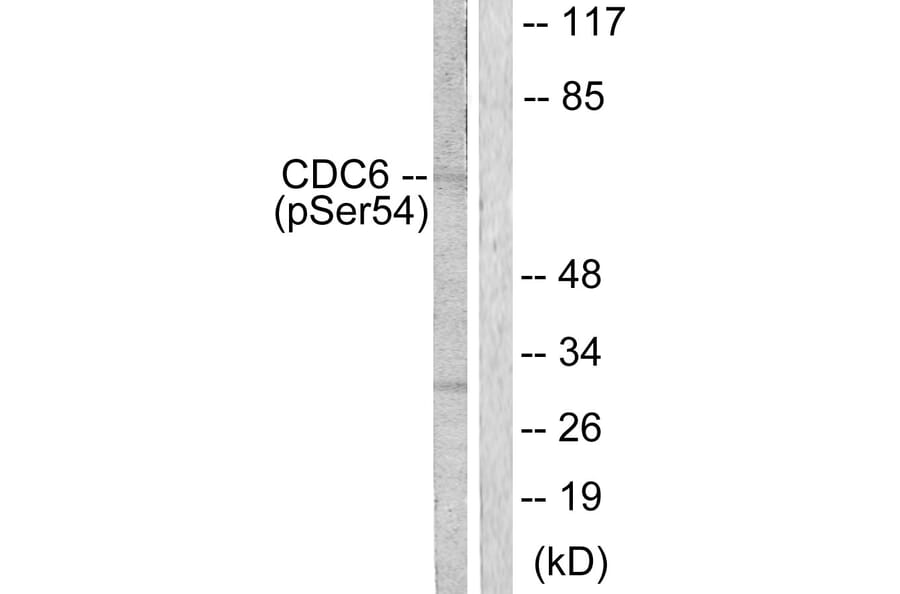 Western Blot - Anti-CDC6 (phospho Ser54) Antibody (A0413) - Antibodies.com