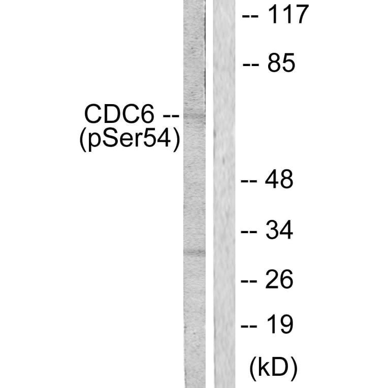 Western Blot - Anti-CDC6 (phospho Ser54) Antibody (A0413) - Antibodies.com