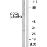 Western Blot - Anti-CDC6 (phospho Ser54) Antibody (A0413) - Antibodies.com