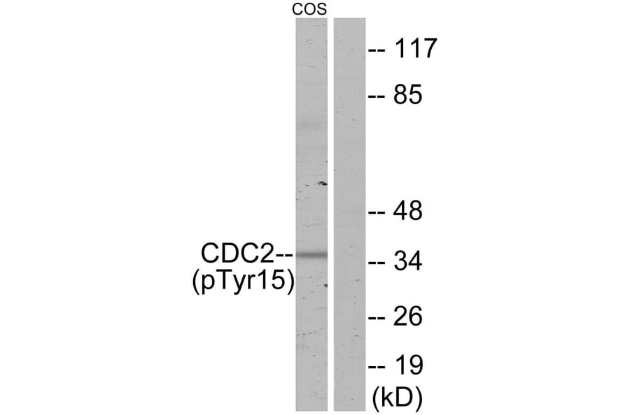 Western Blot - Anti-CDC2 (phospho Tyr15) Antibody (A7036) - Antibodies.com