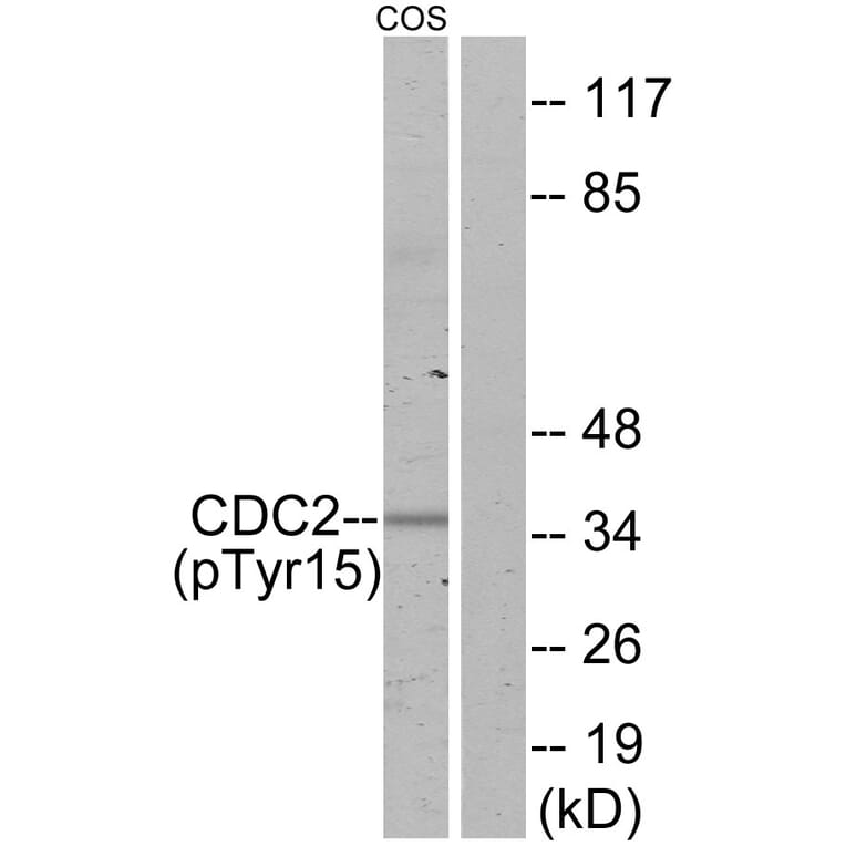 Western Blot - Anti-CDC2 (phospho Tyr15) Antibody (A7036) - Antibodies.com