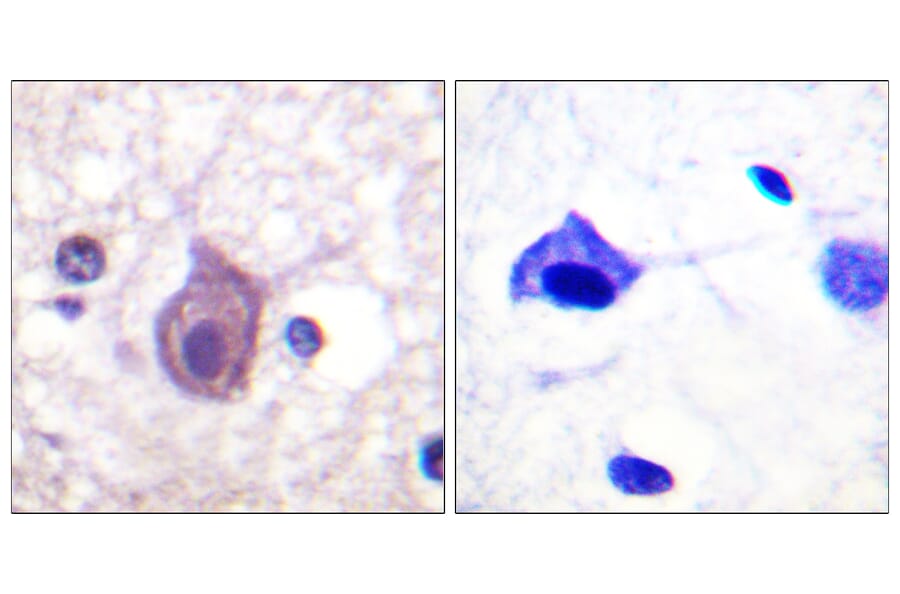 Immunohistochemistry - Anti-CD4 (phospho Ser433) Antibody (A0846) - Antibodies.com
